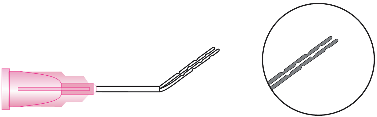 Lasik Double Arm Cannula